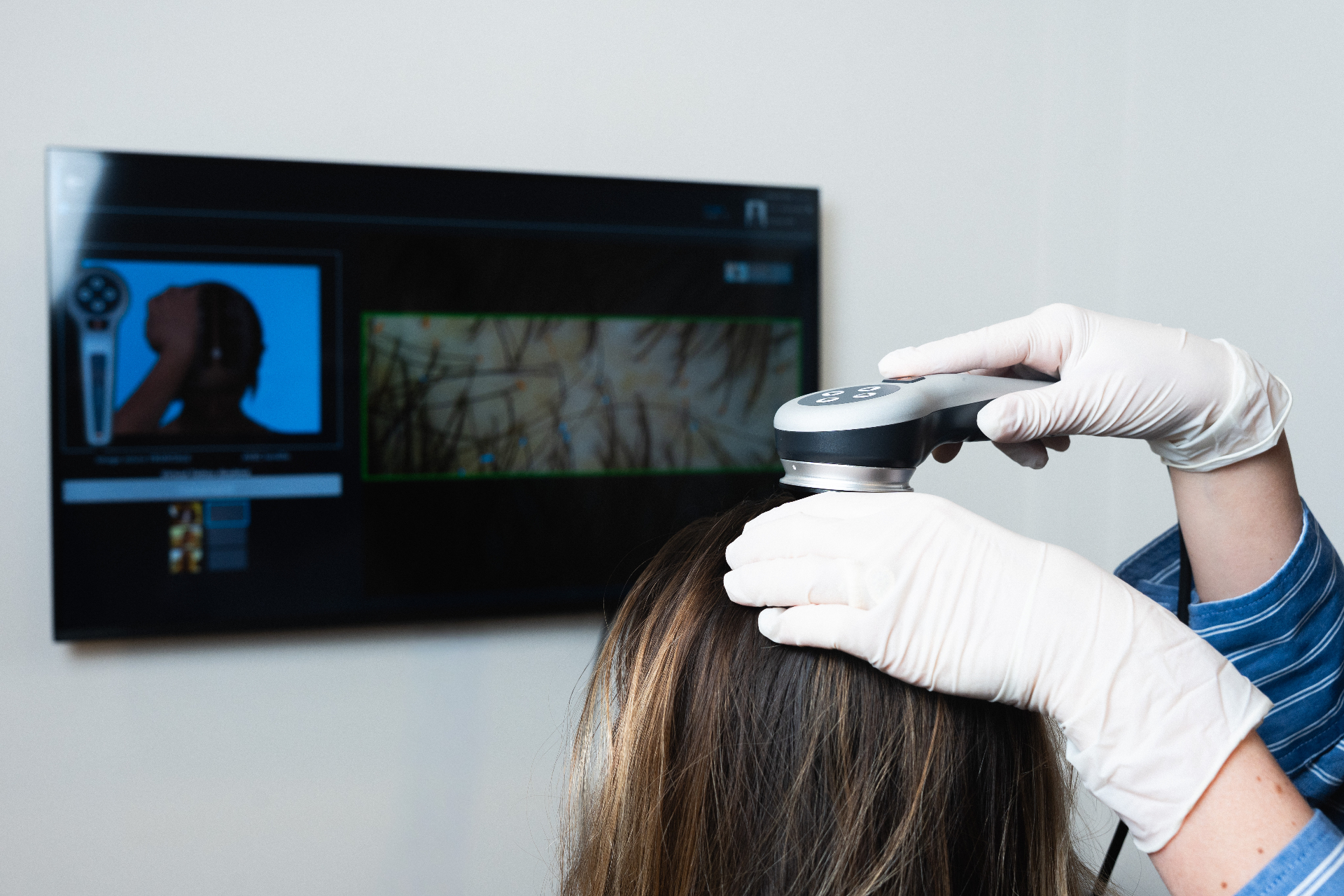 Analyse trichoscopique — Dr Rebecca Freiss, Maison Marignan
